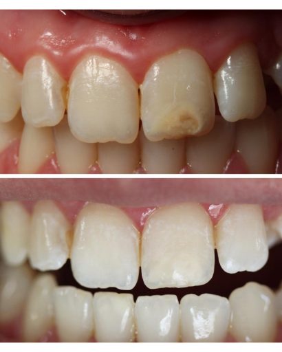 Before - Waterden Dental Practice