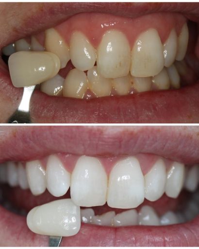 Before - Waterden Dental Practice