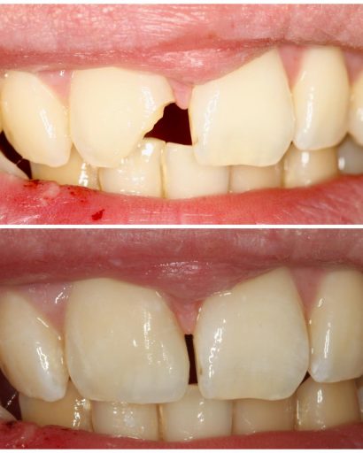 Before - Waterden Dental Practice