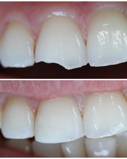 Before - Waterden Dental Practice