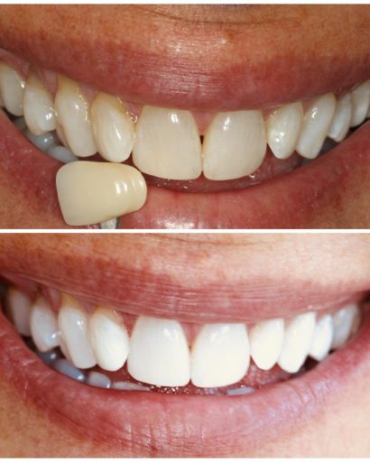 Before - Waterden Dental Practice