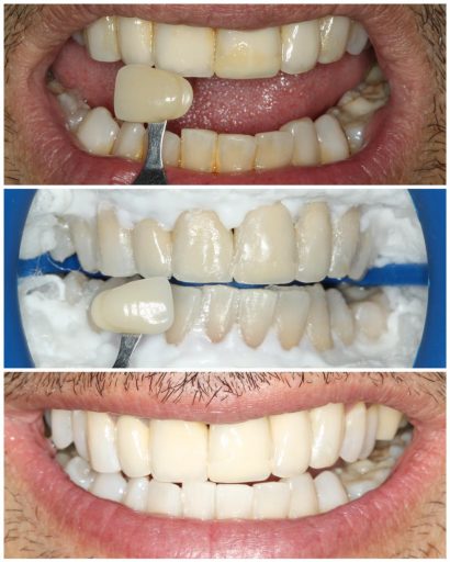 Before - Waterden Dental Practice